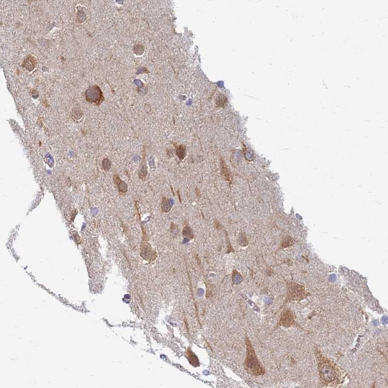 EEA1 Antibody - BSA Free Immunohistochemistry: EEA1 Antibody - BSA Free [NBP1-91860]