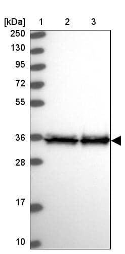 EEF1D Antibody - BSA Free Western Blot: EEF1D Antibody - BSA Free [NBP1-91861]