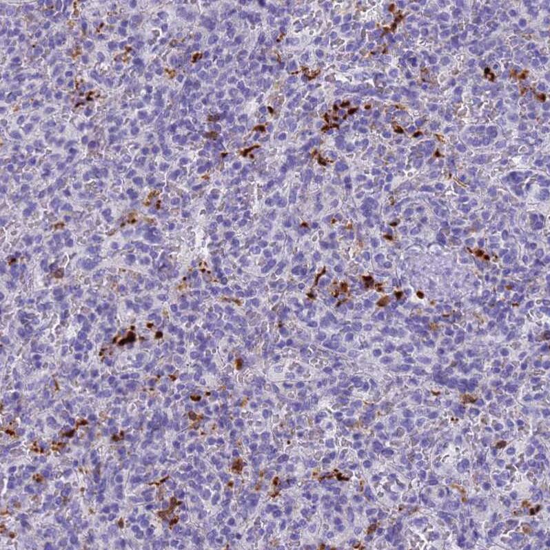 Eosinophil derived neurotoxin Antibody - BSA Free Immunohistochemistry: Eosinophil derived neurotoxin Antibody - BSA Free [NBP1-91872]