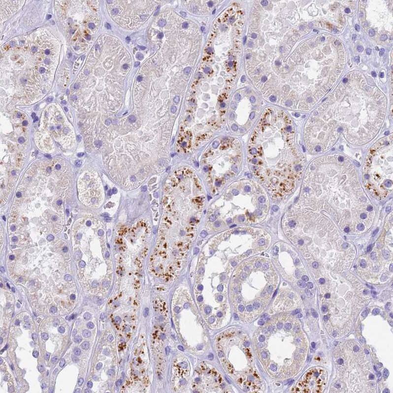 Eosinophil derived neurotoxin Antibody - BSA Free Immunohistochemistry: Eosinophil derived neurotoxin Antibody - BSA Free [NBP1-91872]