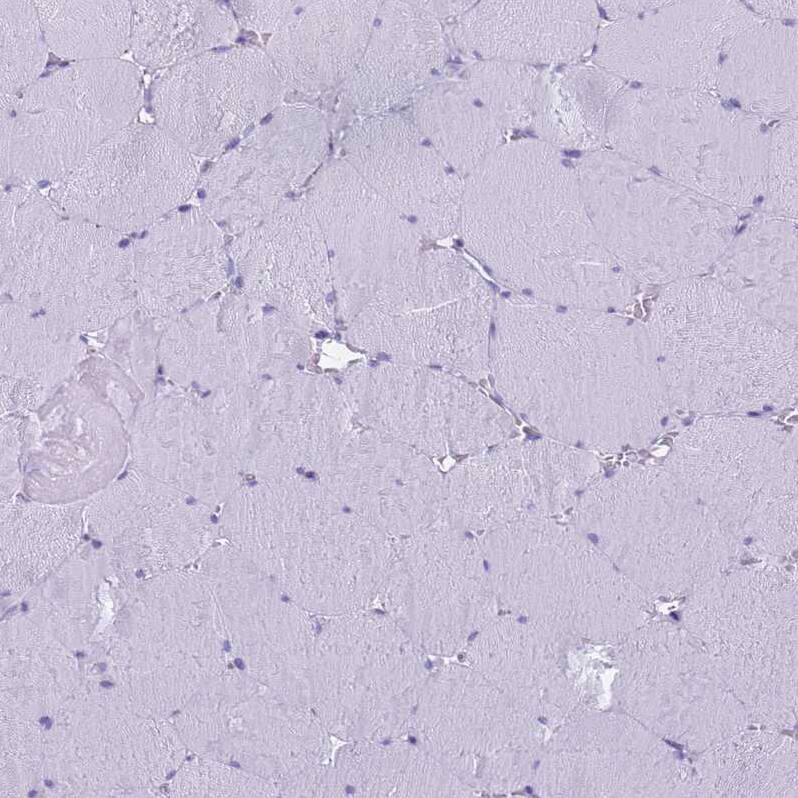 Eosinophil derived neurotoxin Antibody - BSA Free Immunohistochemistry: Eosinophil derived neurotoxin Antibody - BSA Free [NBP1-91872]