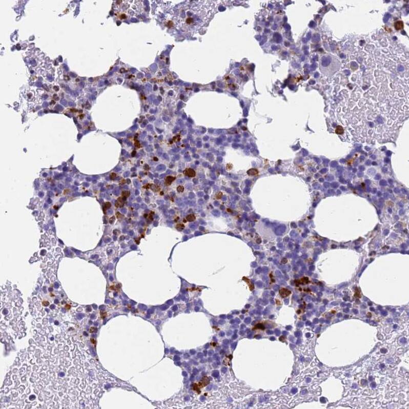 Eosinophil derived neurotoxin Antibody - BSA Free Immunohistochemistry: Eosinophil derived neurotoxin Antibody - BSA Free [NBP1-91872]