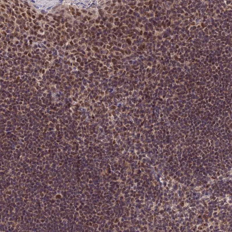 EXOSC3 Antibody - BSA Free Immunohistochemistry: EXOSC3 Antibody - BSA Free [NBP1-91874]