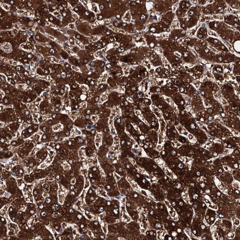 FAAP24 Antibody - BSA Free Immunohistochemistry: FAAP24 Antibody - BSA Free [NBP1-91876]