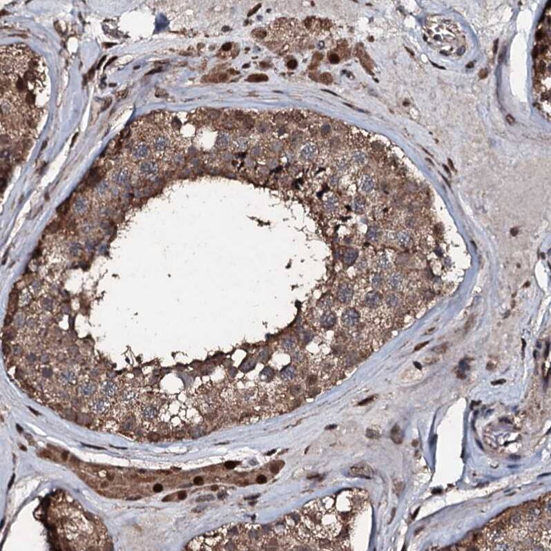 FAAP24 Antibody - BSA Free Immunohistochemistry: FAAP24 Antibody - BSA Free [NBP1-91876]