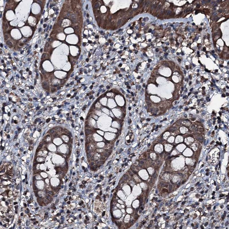 FAAP24 Antibody - BSA Free Immunohistochemistry: FAAP24 Antibody - BSA Free [NBP1-91876]