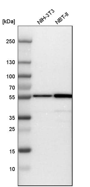 Fascin Antibody - BSA Free Western Blot: Fascin Antibody - BSA Free [NBP1-91887]