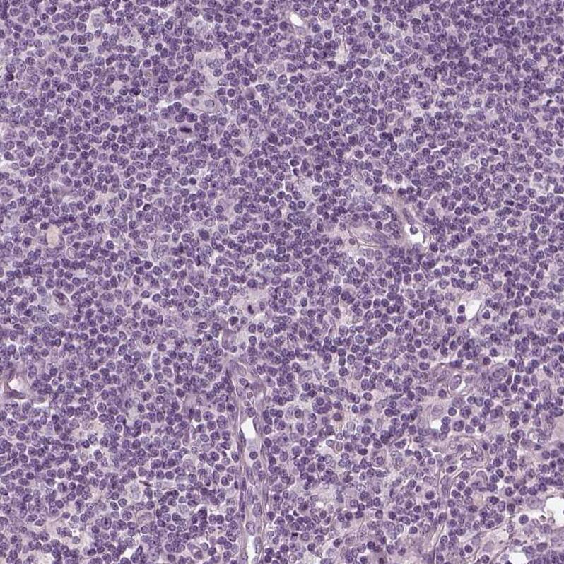 Filensin Antibody - BSA Free Immunohistochemistry: Filensin Antibody - BSA Free [NBP1-91902]