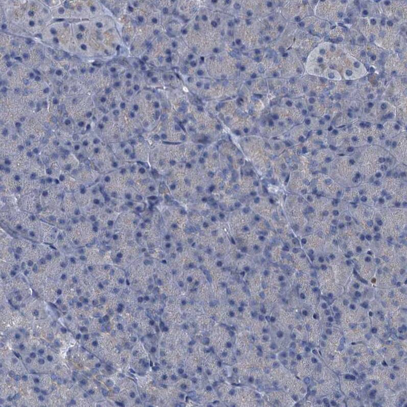 FLJ14154 Antibody - BSA Free Immunohistochemistry: FLJ14154 Antibody - BSA Free [NBP1-91904]