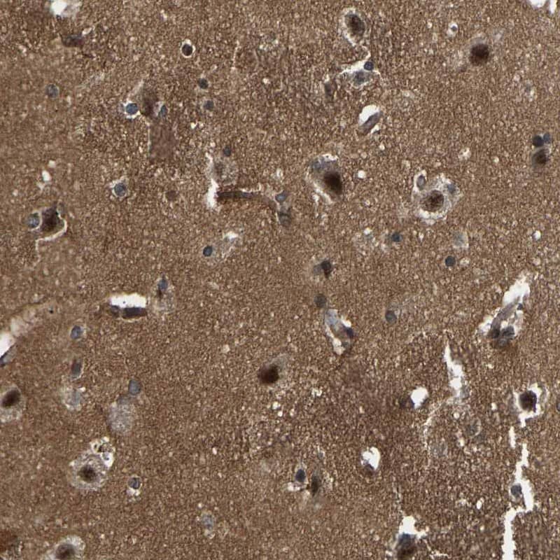 FLJ37078 Antibody - BSA Free Immunohistochemistry: FLJ37078 Antibody - BSA Free [NBP1-91906]