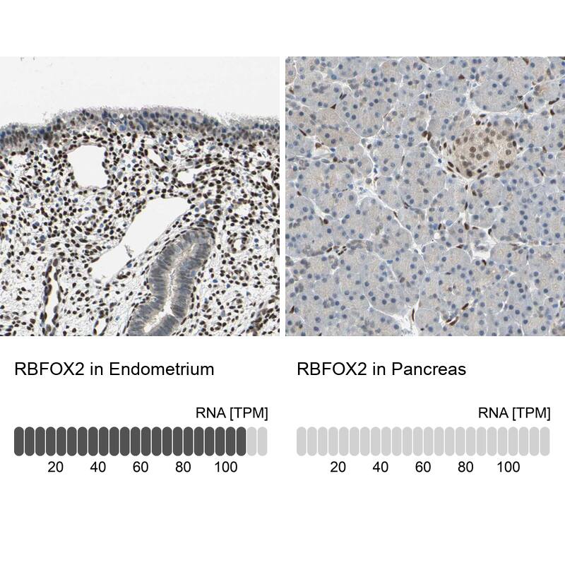 FOX2 Antibody - BSA Free Immunohistochemistry: FOX2 Antibody - BSA Free [NBP1-91910]