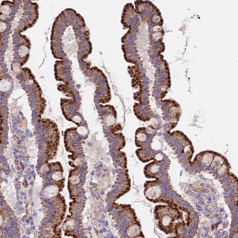 FRMPD1 Antibody - BSA Free Immunohistochemistry: FRMPD1 Antibody - BSA Free [NBP1-91912]