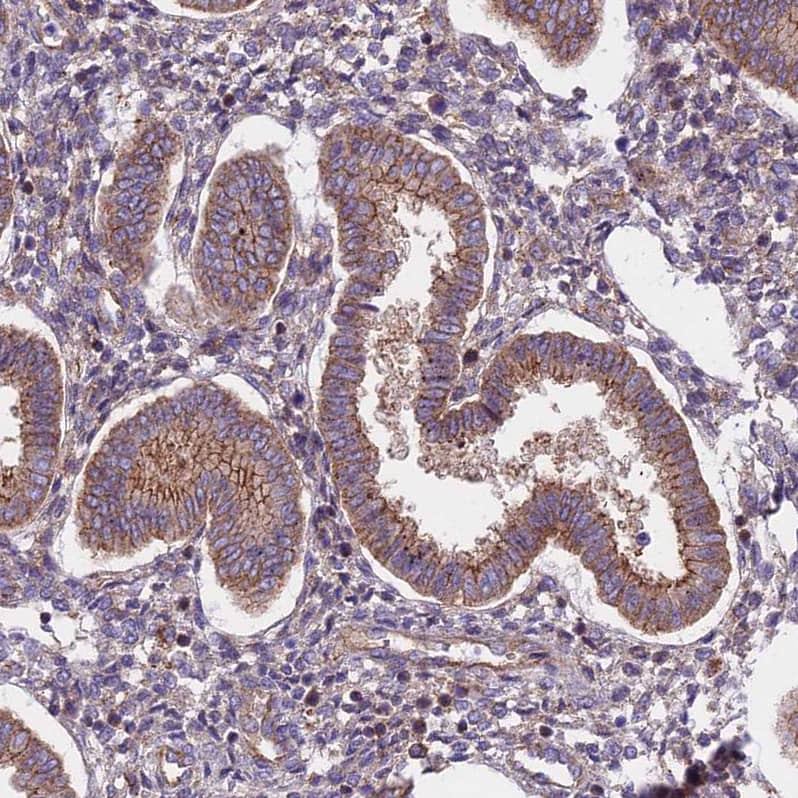 FRMPD1 Antibody - BSA Free Immunohistochemistry: FRMPD1 Antibody - BSA Free [NBP1-91912]