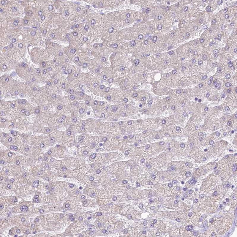 GAT3 Antibody - BSA Free Immunohistochemistry: GAT3 Antibody - BSA Free [NBP1-91920]