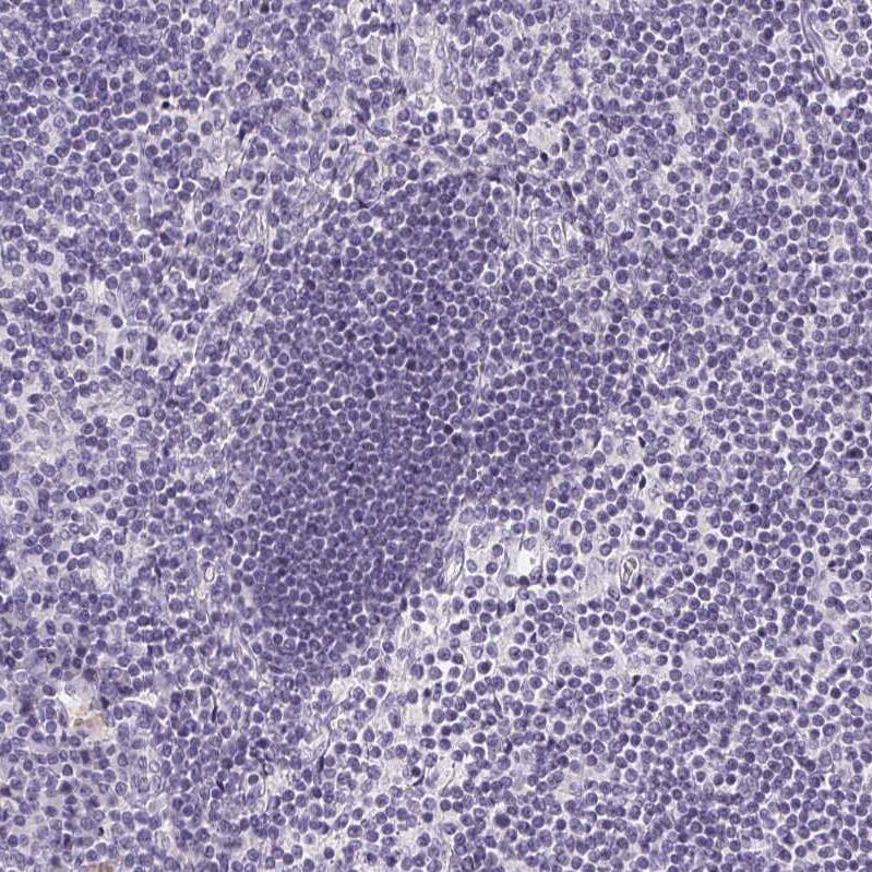 Gasdermin-C Antibody - BSA Free Immunohistochemistry: Gasdermin-C Antibody - BSA Free [NBP1-91926]
