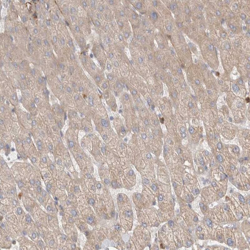 Gasdermin like Antibody - BSA Free Immunohistochemistry: Gasdermin like Antibody - BSA Free [NBP1-91927]