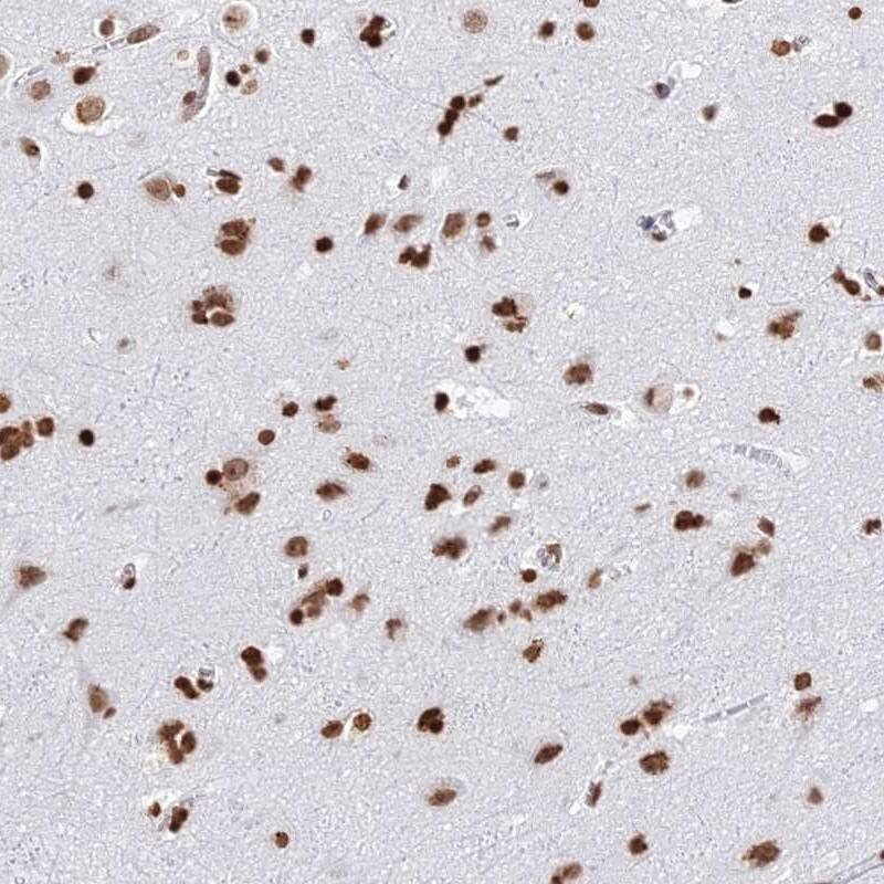 GBP3 Antibody - BSA Free Immunohistochemistry: GBP3 Antibody - BSA Free [NBP1-91929]