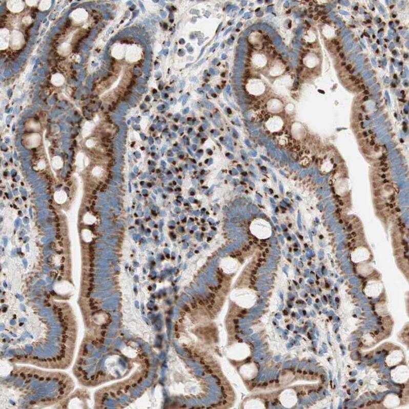 GOLGB1/Giantin Antibody - BSA Free Immunohistochemistry: GOLGB1/Giantin Antibody - BSA Free [NBP1-91937]