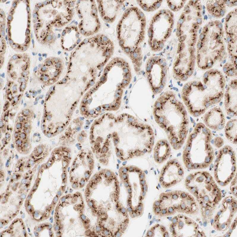 GOLGB1/Giantin Antibody - BSA Free Immunohistochemistry: GOLGB1/Giantin Antibody - BSA Free [NBP1-91937]