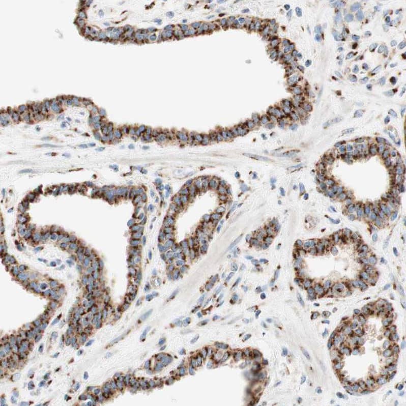 GOLGB1/Giantin Antibody - BSA Free Immunohistochemistry: GOLGB1/Giantin Antibody - BSA Free [NBP1-91937]