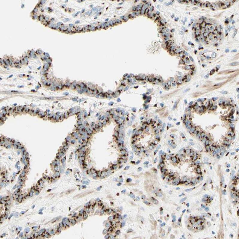 GOLGB1/Giantin Antibody - BSA Free Immunohistochemistry: GOLGB1/Giantin Antibody - BSA Free [NBP1-91938]