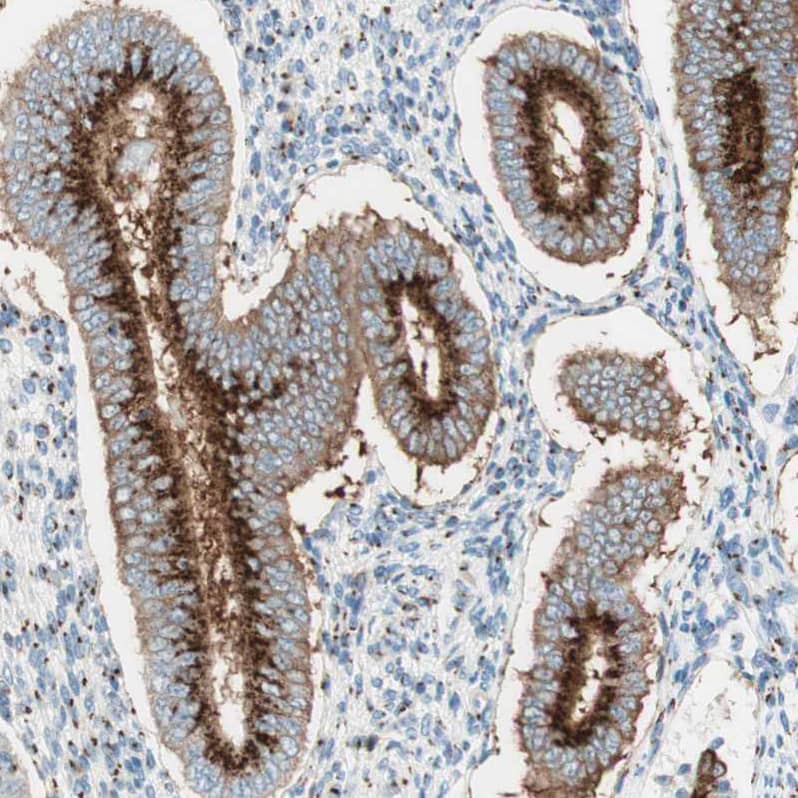 GOLGB1/Giantin Antibody - BSA Free Immunohistochemistry: GOLGB1/Giantin Antibody - BSA Free [NBP1-91938]