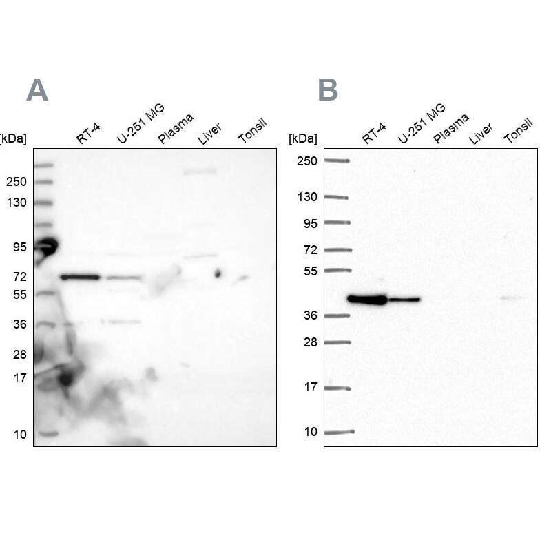 GIPC1 Antibody - BSA Free Western Blot: GIPC1 Antibody - BSA Free [NBP1-91941]