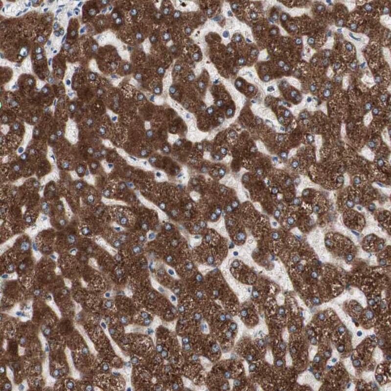 Glucose 1-dehydrogenase Antibody - BSA Free Immunohistochemistry: Glucose 1-dehydrogenase Antibody - BSA Free [NBP1-91942]