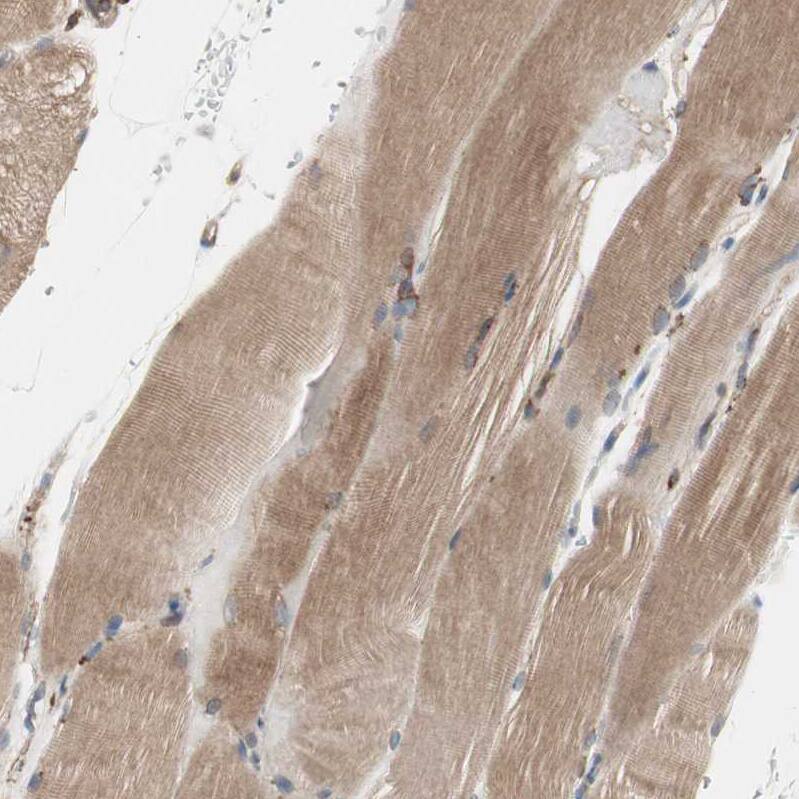 Glucose 1-dehydrogenase Antibody - BSA Free Immunohistochemistry: Glucose 1-dehydrogenase Antibody - BSA Free [NBP1-91942]