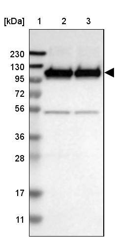 Glutamate Receptor 6 Antibody - BSA Free Western Blot: Glutamate Receptor 6 Antibody - BSA Free [NBP1-91946]