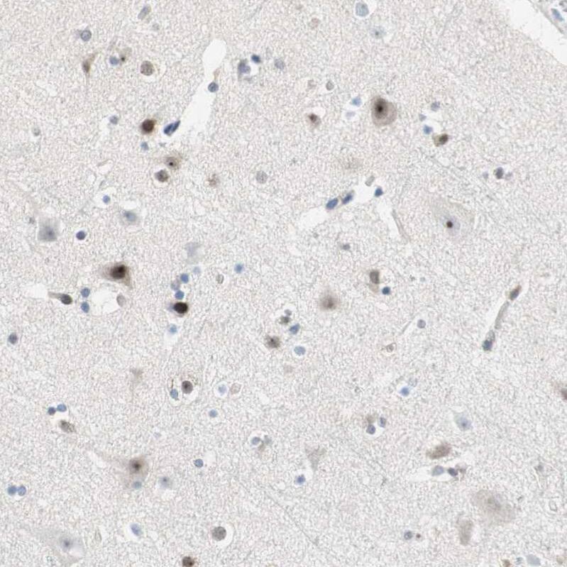 GM632 Antibody - BSA Free Immunohistochemistry: GM632 Antibody - BSA Free [NBP1-91948]