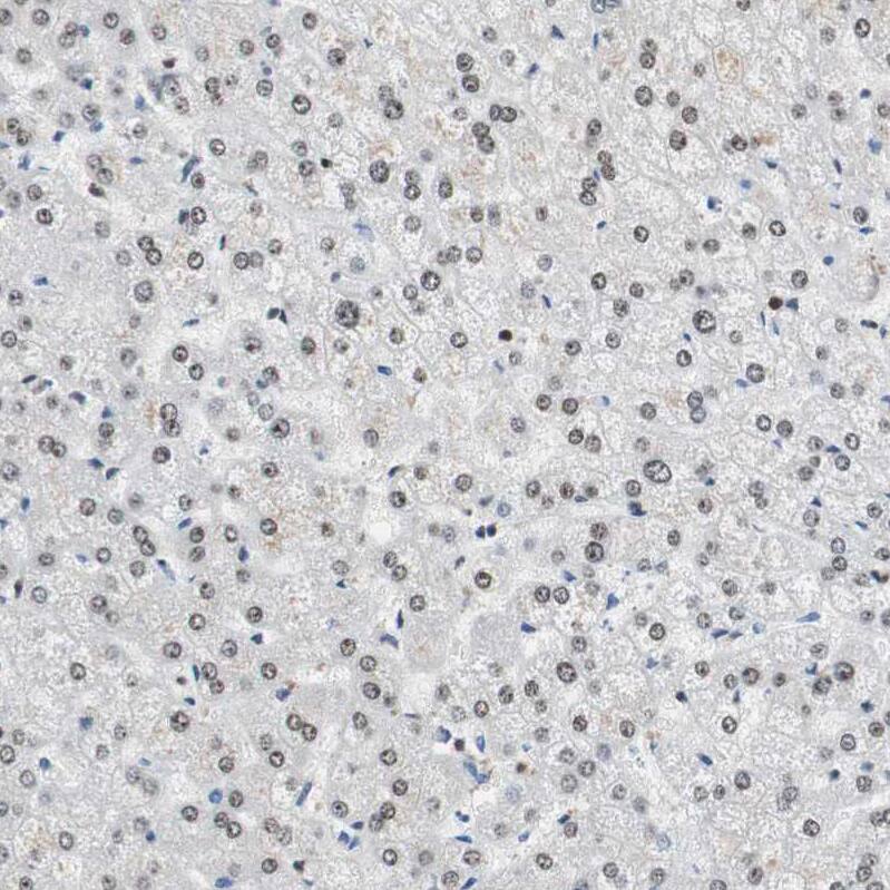 GM632 Antibody - BSA Free Immunohistochemistry: GM632 Antibody - BSA Free [NBP1-91948]