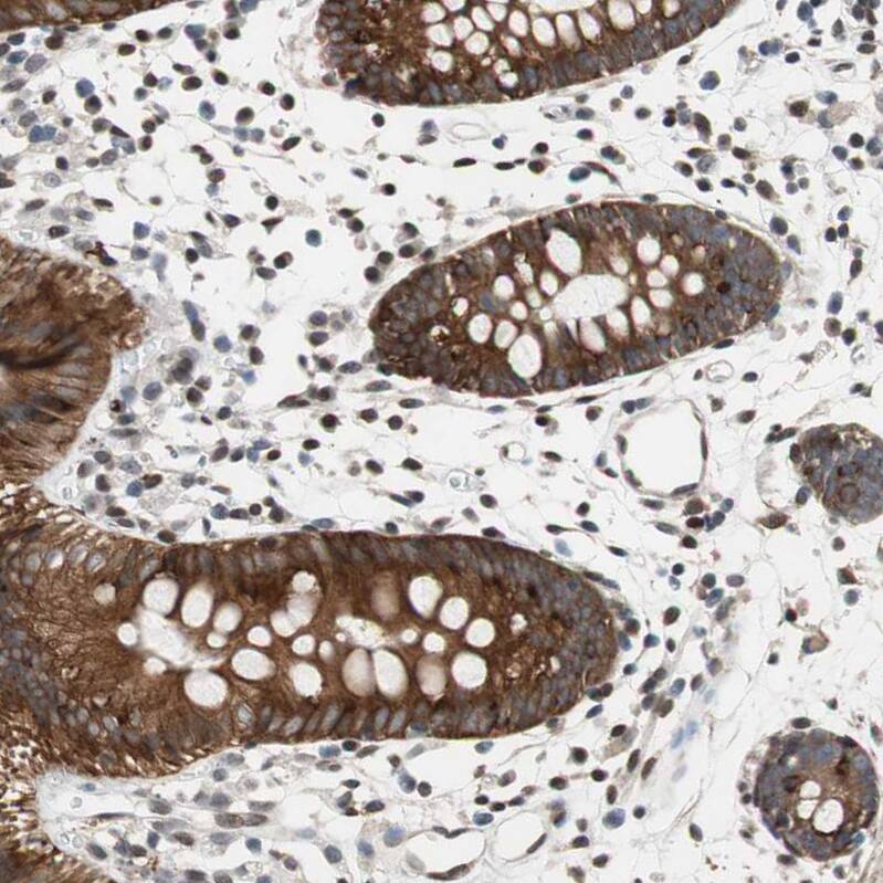 GM632 Antibody - BSA Free Immunohistochemistry: GM632 Antibody - BSA Free [NBP1-91948]
