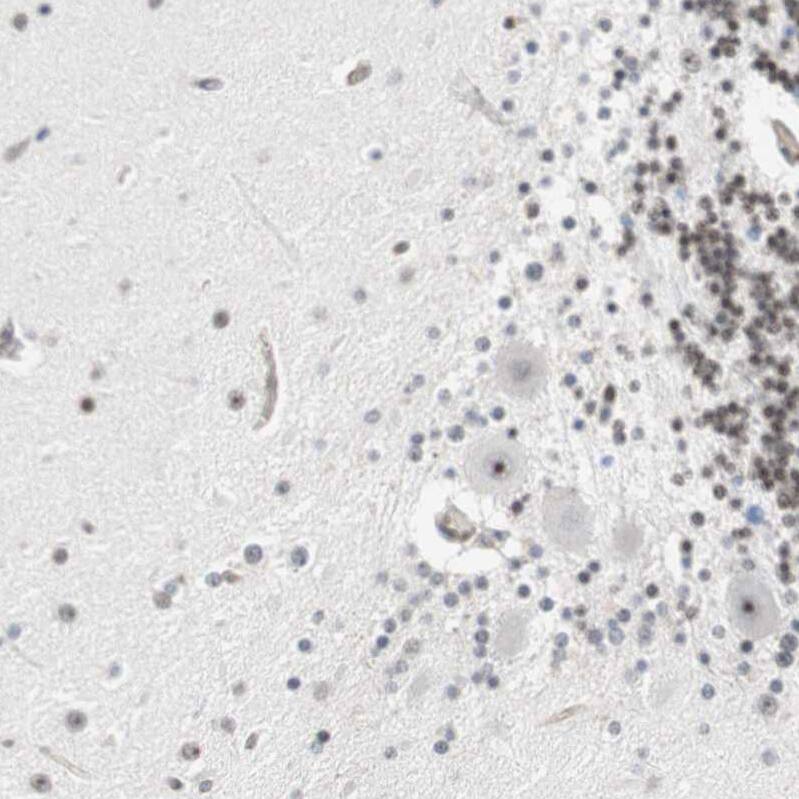 GM632 Antibody - BSA Free Immunohistochemistry: GM632 Antibody - BSA Free [NBP1-91948]