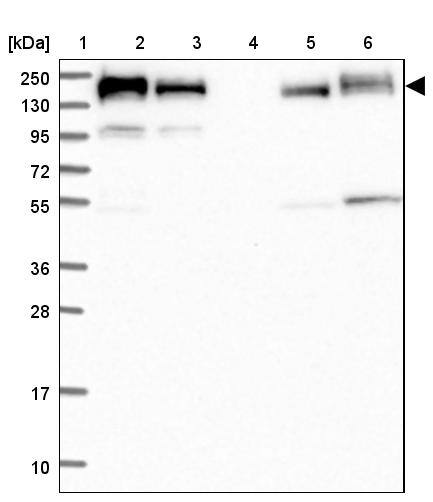 GOLGA3 Antibody - BSA Free Western Blot: GOLGA3 Antibody - BSA Free [NBP1-91952]