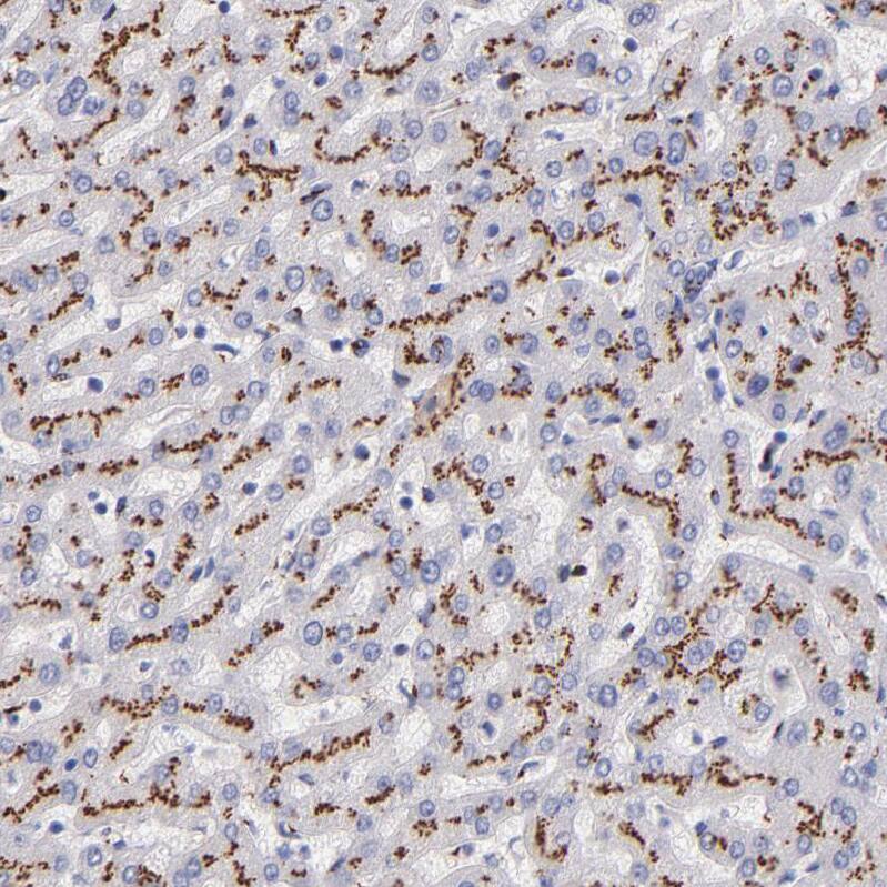 GOLPH4 Antibody - BSA Free Immunohistochemistry: GOLPH4 Antibody - BSA Free [NBP1-91954]