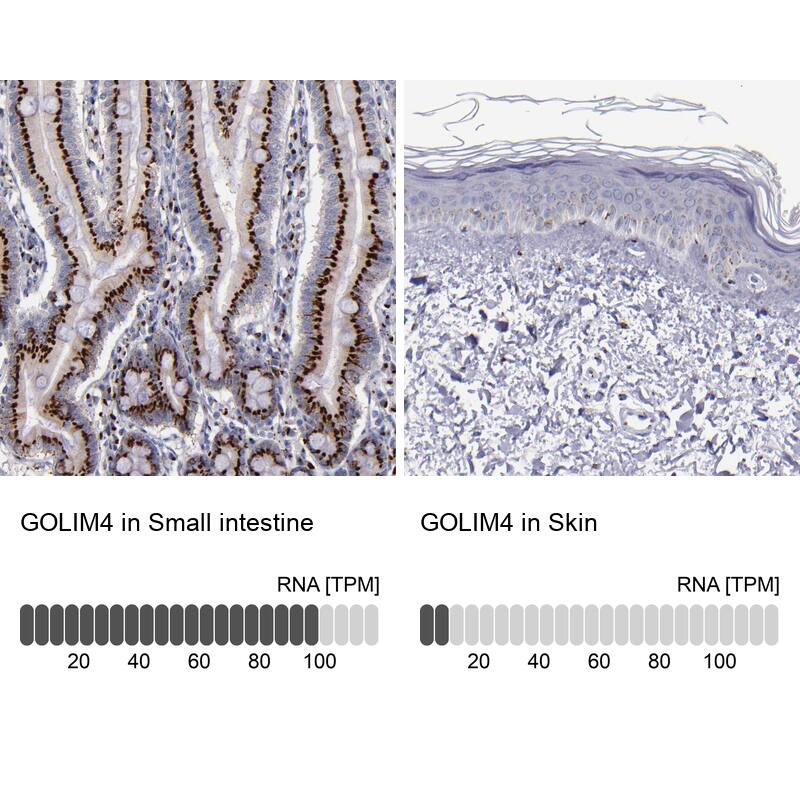GOLPH4 Antibody - BSA Free Immunohistochemistry: GOLPH4 Antibody - BSA Free [NBP1-91954]