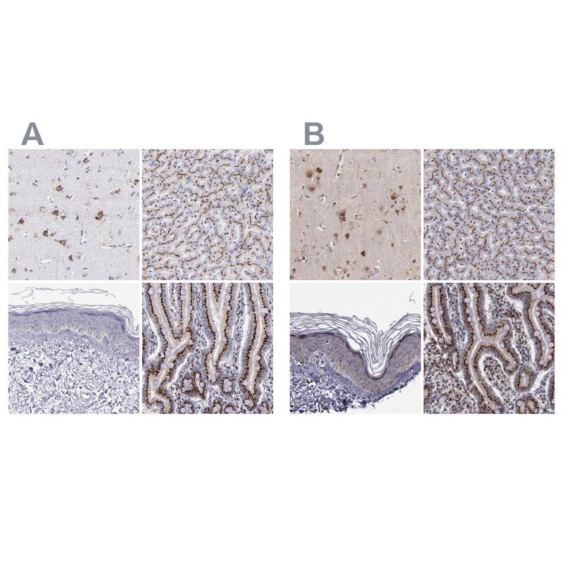 GOLPH4 Antibody - BSA Free Immunohistochemistry: GOLPH4 Antibody - BSA Free [NBP1-91954]
