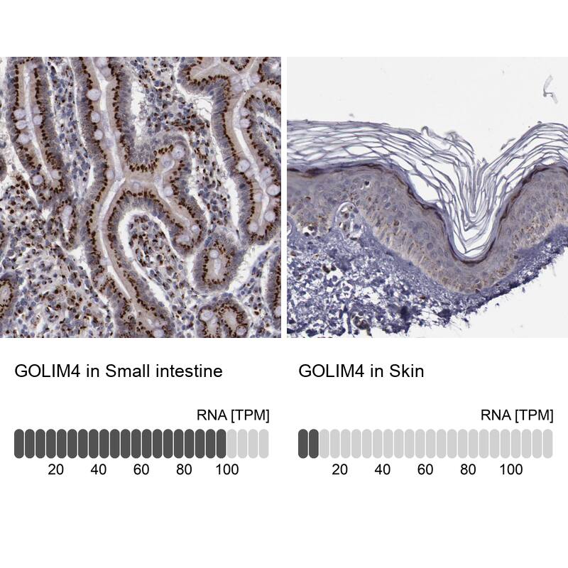 GOLPH4 Antibody - BSA Free Immunohistochemistry: GOLPH4 Antibody - BSA Free [NBP1-91955]