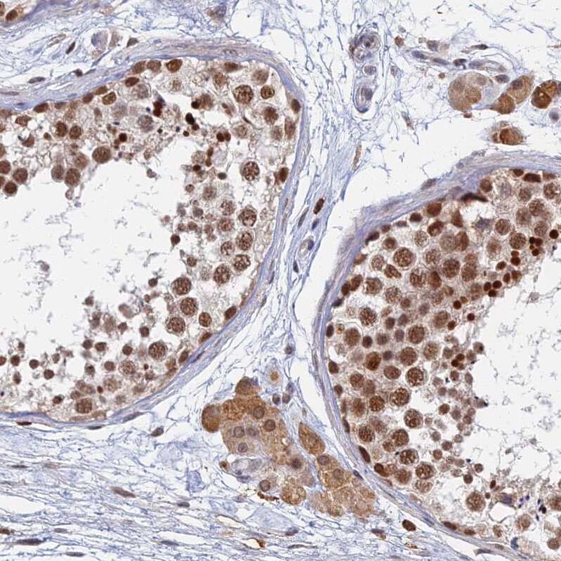 GPATCH1 Antibody - BSA Free Immunohistochemistry: GPATCH1 Antibody - BSA Free [NBP1-91958]