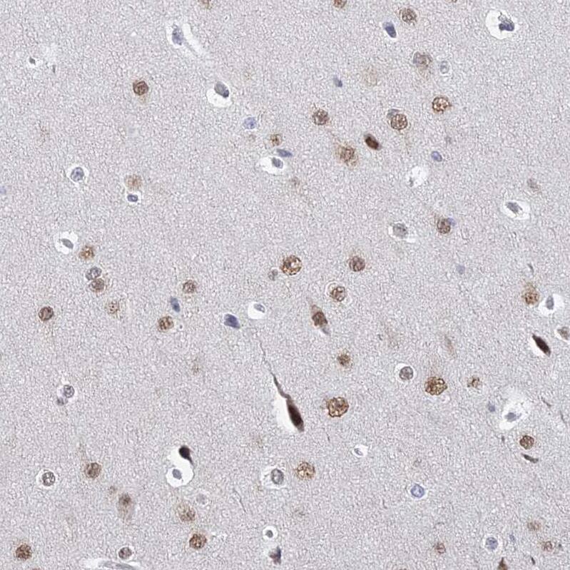GPATCH1 Antibody - BSA Free Immunohistochemistry: GPATCH1 Antibody - BSA Free [NBP1-91958]