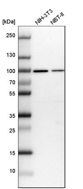 GPATCH1 Antibody - BSA Free Western Blot: GPATCH1 Antibody - BSA Free [NBP1-91958]