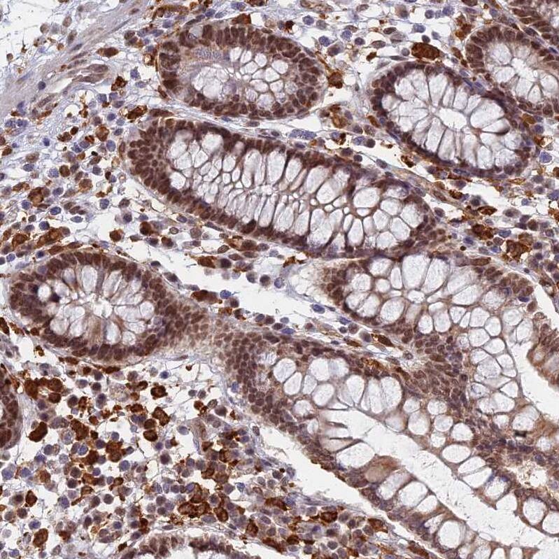 GPATCH1 Antibody - BSA Free Immunohistochemistry: GPATCH1 Antibody - BSA Free [NBP1-91958]