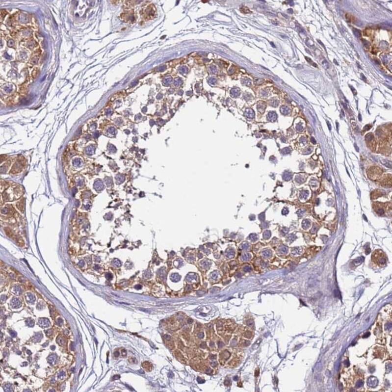GSPT2 Antibody - BSA Free Immunohistochemistry: GSPT2 Antibody - BSA Free [NBP1-91971]