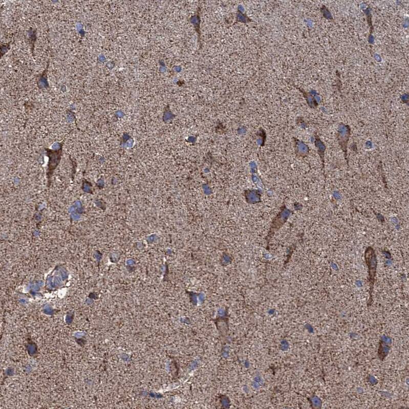 GTPBP3 Antibody - BSA Free Immunohistochemistry: GTPBP3 Antibody - BSA Free [NBP1-91974]