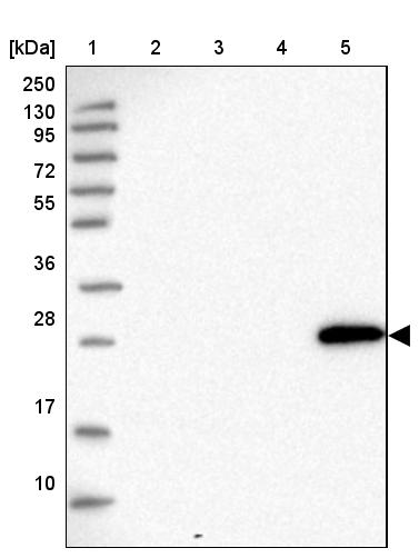 GTPBP5 Antibody - BSA Free Western Blot: GTPBP5 Antibody - BSA Free [NBP1-91975]