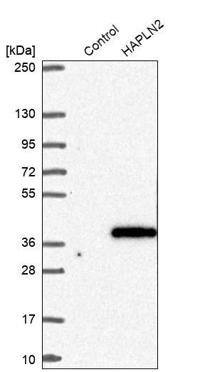 HAPLN2 Antibody - BSA Free Western Blot: HAPLN2 Antibody - BSA Free [NBP1-91977]
