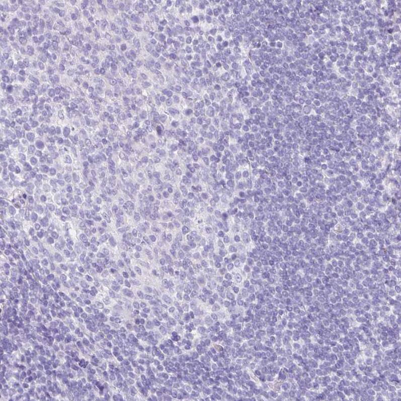 HAPLN2 Antibody - BSA Free Immunohistochemistry: HAPLN2 Antibody - BSA Free [NBP1-91977]