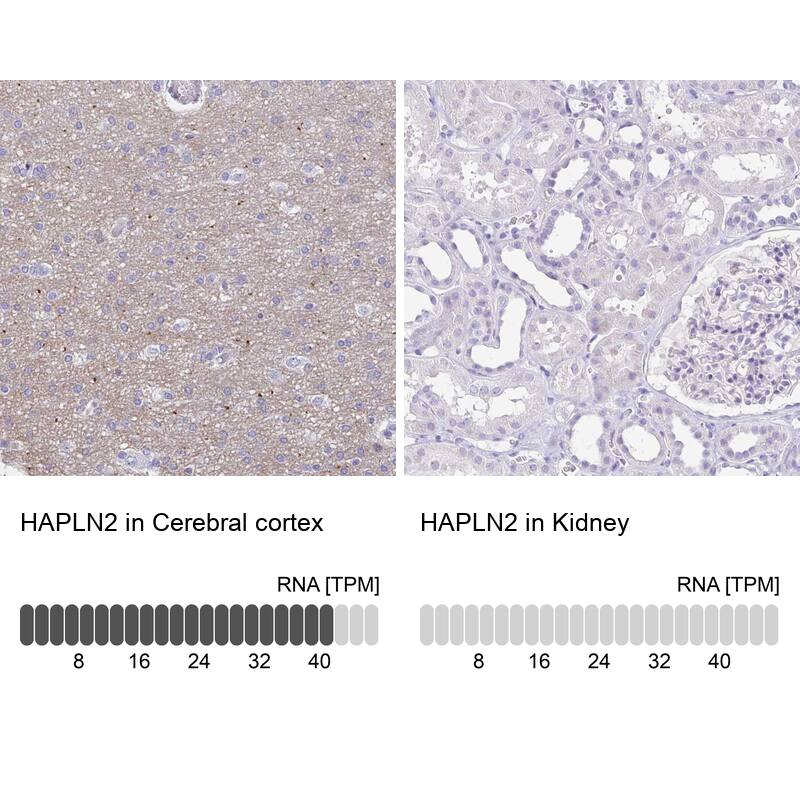HAPLN2 Antibody - BSA Free Immunohistochemistry: HAPLN2 Antibody - BSA Free [NBP1-91977]