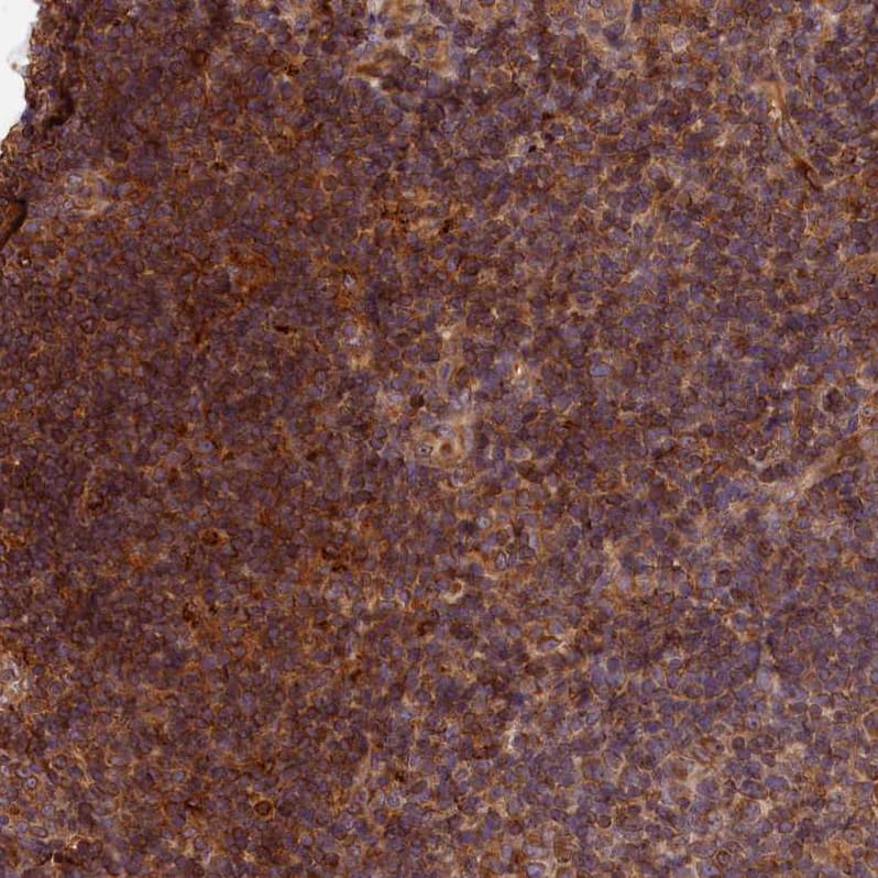 HO-2/HMOX2 Antibody - BSA Free Immunohistochemistry: HO-2/HMOX2 Antibody - BSA Free [NBP1-91981]